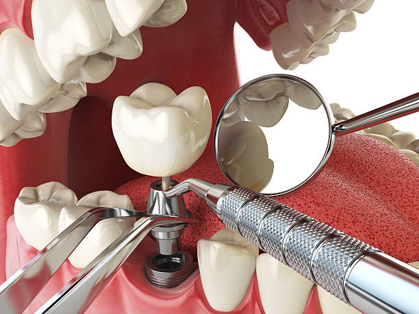 Best Weekend Emergency Dental Services in Macon, IL